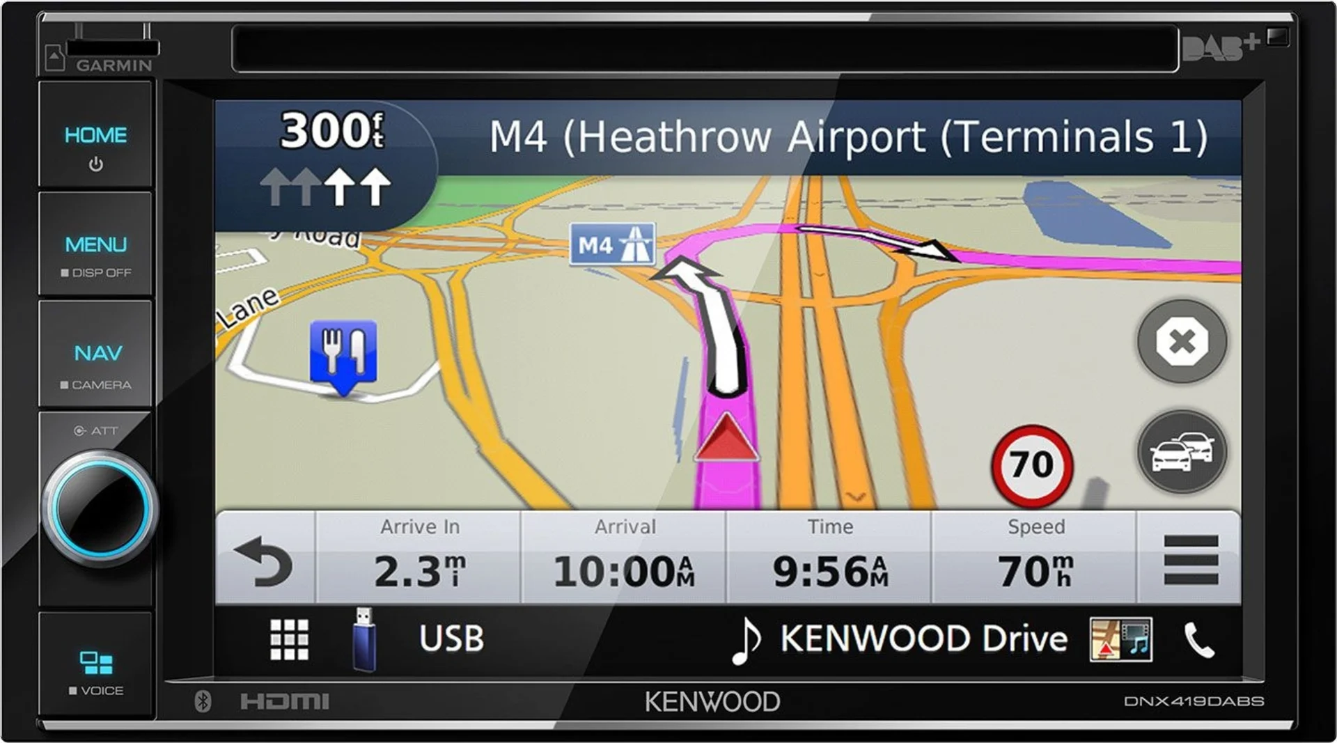 Kenwood DNX419DABS Système de navigation multimédia 6,